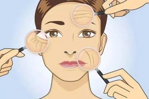 沈陽杏林張宇夫醫(yī)生做小切口除皺好，微創(chuàng)面中部小切口提升價格1.4w+