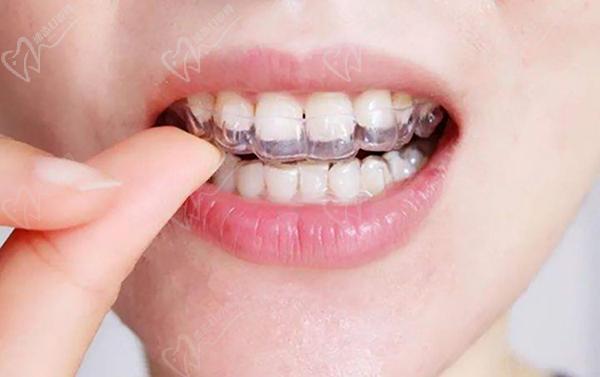 網(wǎng)購牙套戴出問題了怎么辦？