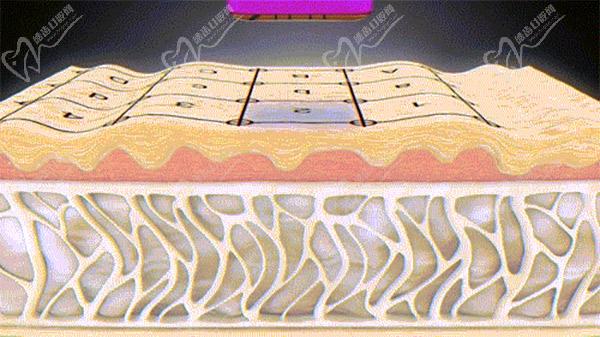 熱瑪吉和歐洲之星哪個(gè)提升緊致效 果好