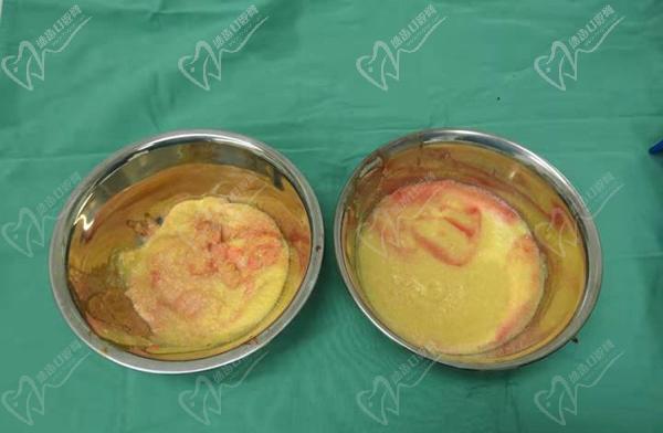 國內(nèi)異物取出醫(yī)生排名前十名