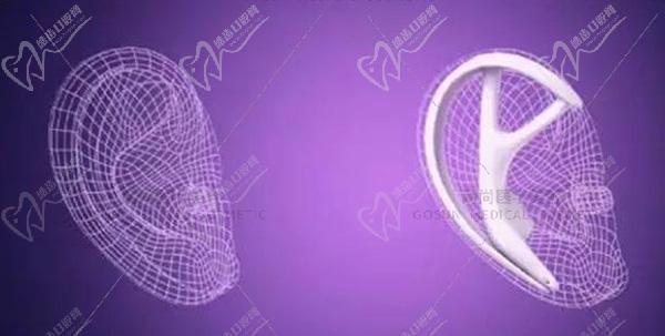 八大處耳再造手術(shù)哪個(gè)醫(yī)生好