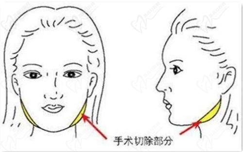 沈陽(yáng)杏林朱石江醫(yī)生頜面手術(shù)怎么樣