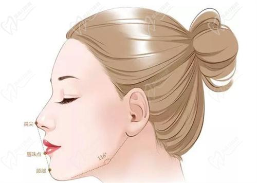 沈陽(yáng)杏林朱石江醫(yī)生做下頜角整形