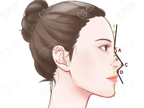 朱石江醫(yī)生隆鼻技術(shù)優(yōu)勢