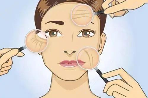 沈陽杏林張宇夫醫(yī)生做小切口除皺好嗎