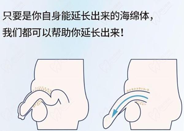 男科咨詢在線醫(yī)生免費(fèi)