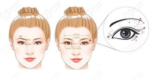 蘇州美貝爾陳光做眼睛修復(fù)