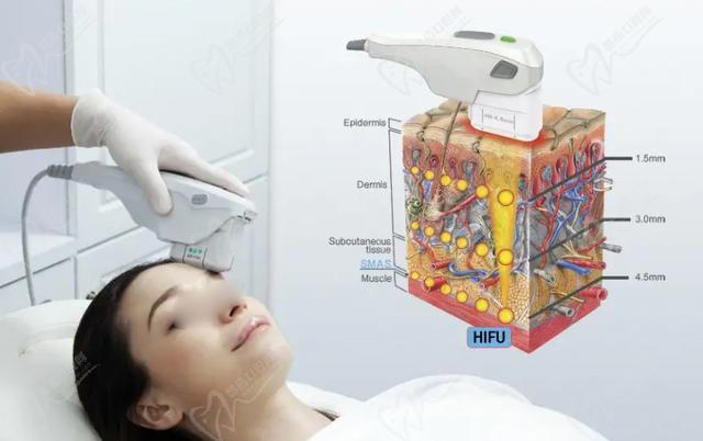 沈陽超聲炮哪個醫(yī)生做的好