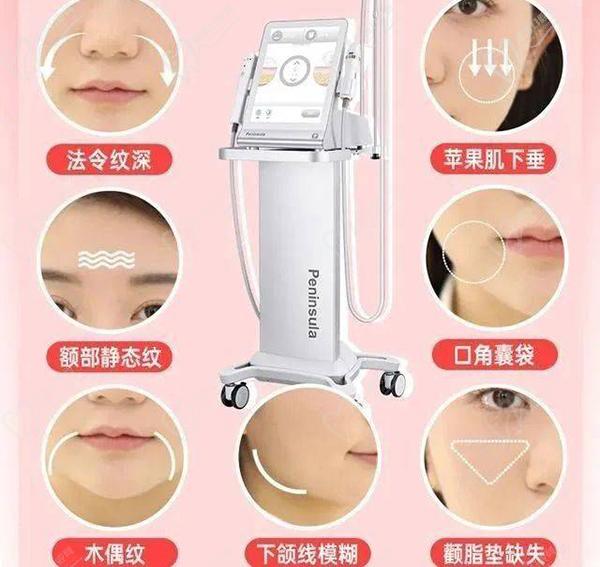 沈陽超聲炮多少錢