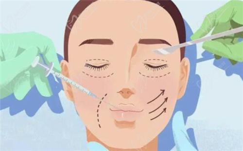 為什么選擇師麗麗院長(zhǎng)進(jìn)行雙眼皮修復(fù)？