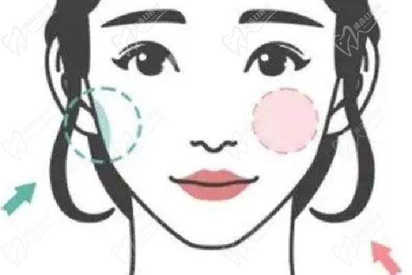 武漢藝星朱勝軍打除 皺針預(yù)約掛號