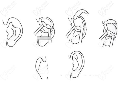段偉強醫(yī)生技術成就與學術貢獻