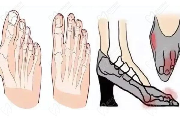 溫建民骨科醫(yī)院預(yù)約掛號方式 —— 多種渠道全攻略