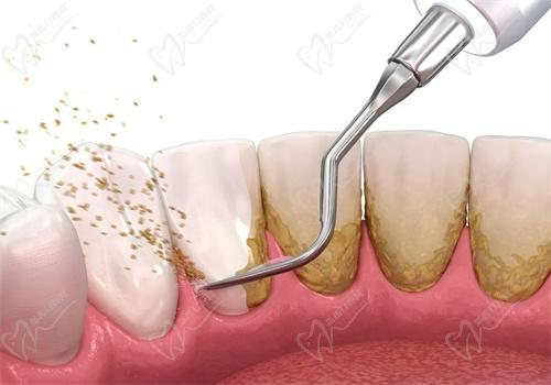 廣安愛牙仕口腔靠譜嗎