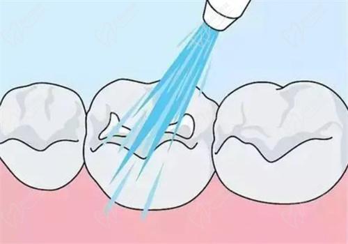 廣安愛牙仕口腔靠譜嗎