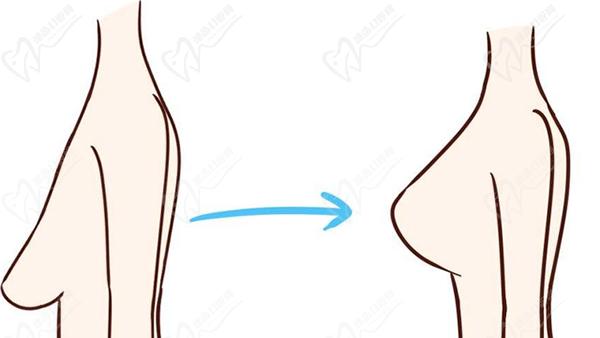 沈陽(yáng)胸部懸吊術(shù)誰(shuí)做的好