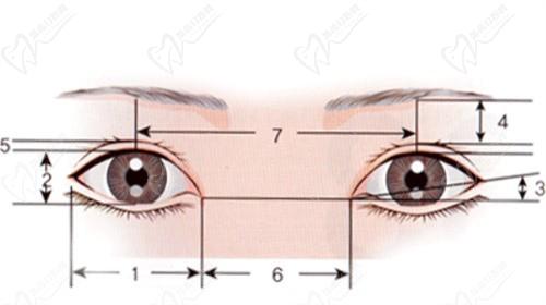 沈陽杏林整形杜繼鳳醫(yī)生雙眼皮修復(fù)費用2.9W+,去除肉條感輕松拿捏